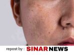 sinarnews_aron_lastrin_advokat_pengacara_nikolas_naibaho